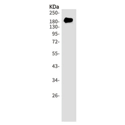 PDGFRA rabbit monoclonal antibody