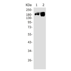 PDGFRB rabbit monoclonal antibody