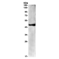 PDK2 rabbit monoclonal antibody