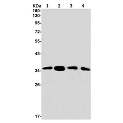 PDLIM1 rabbit monoclonal antibody