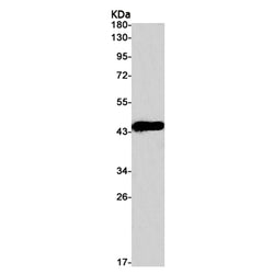 PDSS1 rabbit monoclonal antibody