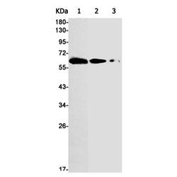 PFKFB3 rabbit monoclonal antibody