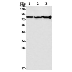 PFKP rabbit monoclonal antibody