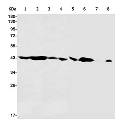 PGK1 rabbit monoclonal antibody