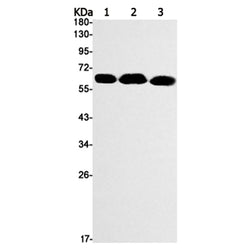 PGM1 rabbit monoclonal antibody