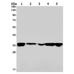 PHB2 rabbit monoclonal antibody