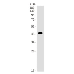 PHLDA1 rabbit monoclonal antibody