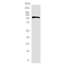 PIK3CA rabbit monoclonal antibody