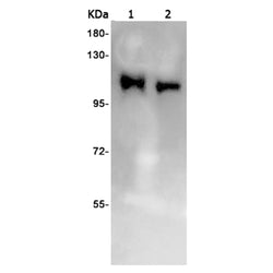 PIK3CB rabbit monoclonal antibody