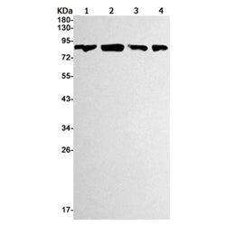 PIK3R1 rabbit monoclonal antibody