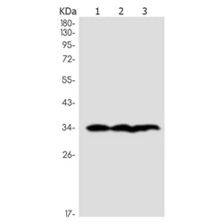 PIM1 rabbit monoclonal antibody