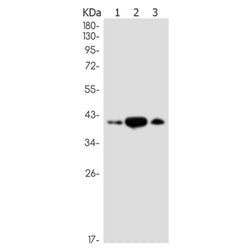 PIM2 rabbit monoclonal antibody