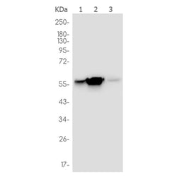 PKM rabbit monoclonal antibody