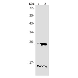 PLN rabbit monoclonal antibody