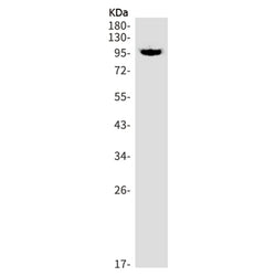PML rabbit monoclonal antibody