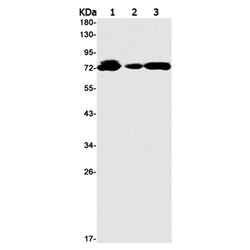 POT1 rabbit monoclonal antibody