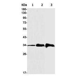 PPA1 rabbit monoclonal antibody
