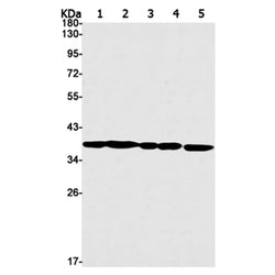 PPP1CB rabbit monoclonal antibody