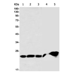 PRDX2 rabbit monoclonal antibody