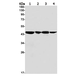 PREB rabbit monoclonal antibody