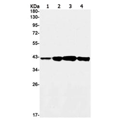 PRKACA rabbit monoclonal antibody