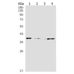 PRKAG1 rabbit monoclonal antibody