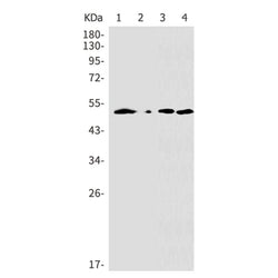 PRKAR2A (phospho-Ser99) rabbit monoclonal antibody