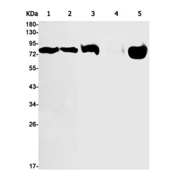 PRKCA (phospho-Thr638) rabbit monoclonal antibody