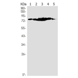 PRKCA/PRKCB/PRKCD/PRKCE/PRKCH/PRKCQ (phospho-Ser660) rabbit monoclonal antibody