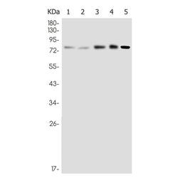 PRKCB rabbit monoclonal antibody