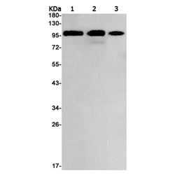 PRKD1 rabbit monoclonal antibody