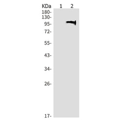 PRKD2 (phospho-Ser876) rabbit monoclonal antibody