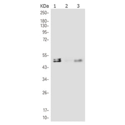 PRKN rabbit monoclonal antibody