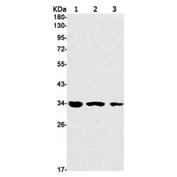 PRKRA rabbit monoclonal antibody