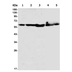 PRPF4 rabbit monoclonal antibody
