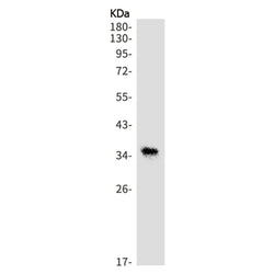 PRSS8 rabbit monoclonal antibody