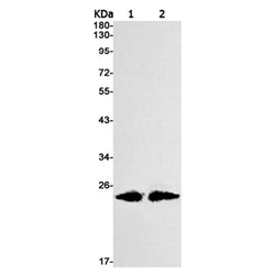 PSEN1 (phospho-Ser310) rabbit monoclonal antibody