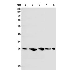 PSMA2 rabbit monoclonal antibody