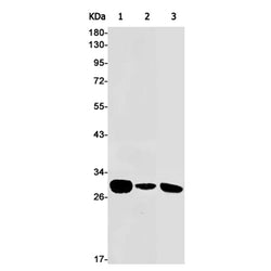 PSMB10 rabbit monoclonal antibody