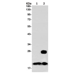 PSMB8 rabbit monoclonal antibody
