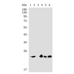 PSMB9 rabbit monoclonal antibody
