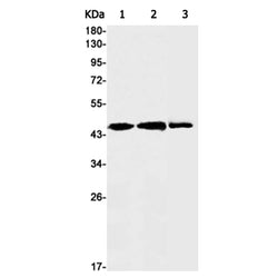 PSMC5 rabbit monoclonal antibody