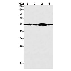 PTEN rabbit monoclonal antibody