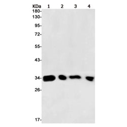 PTGDS rabbit monoclonal antibody