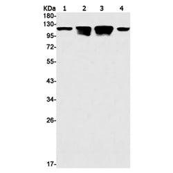 PTK2 rabbit monoclonal antibody