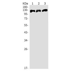 PTK2 (phospho-Tyr576) rabbit monoclonal antibody