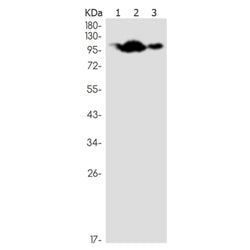 PTK2B rabbit monoclonal antibody