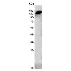 PUM1 rabbit monoclonal antibody