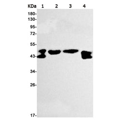 PUS1 rabbit monoclonal antibody