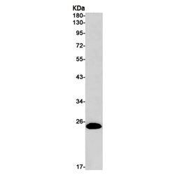 RAB7B rabbit monoclonal antibody